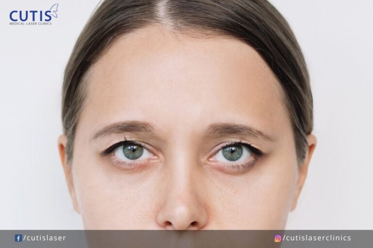 What Causes Drooping Eyebrows & How Can You Fix Them?