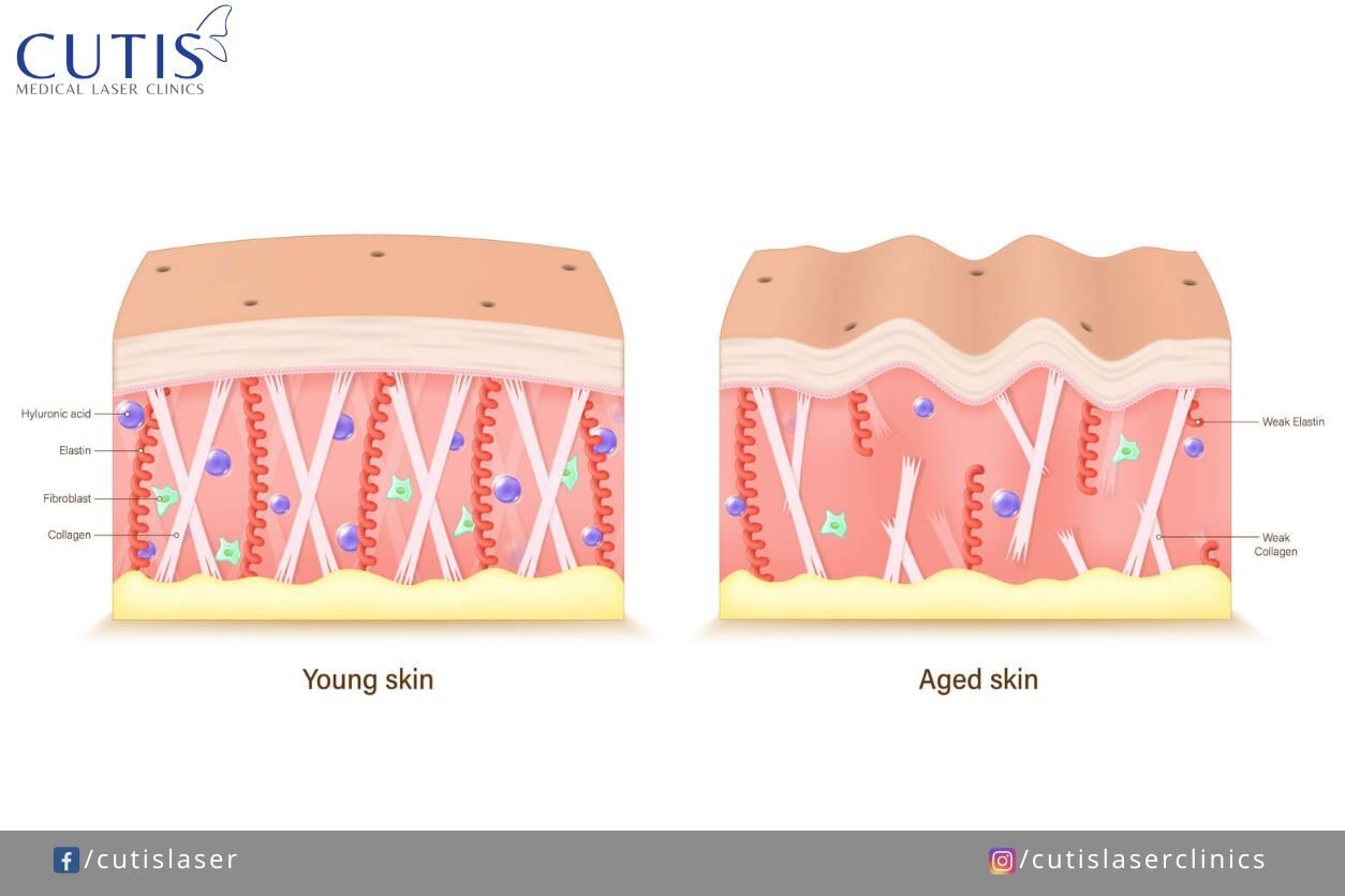 But first, what is collagen 