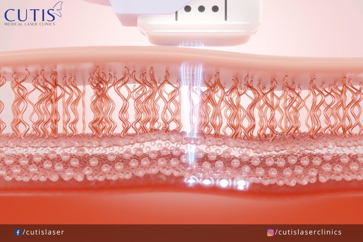 When should you start collagen banking