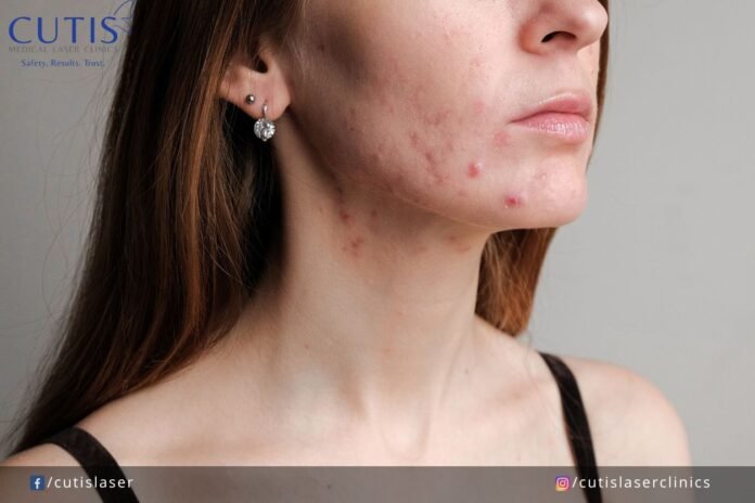 1753545369_Congested-Skin-Causes-Symptoms-and-Treatments.jpg