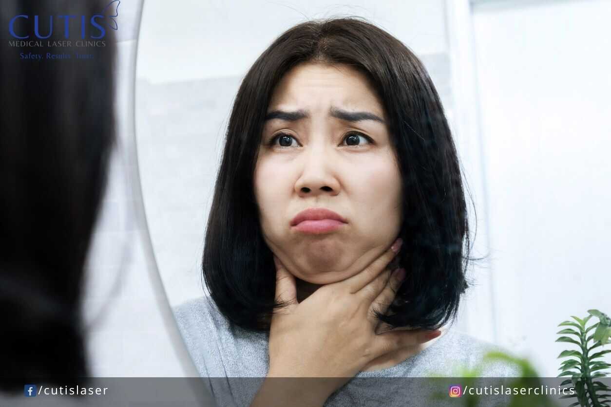 Why Chewing Gum or Tech Neck Exercises are Ineffective for Double Chin
