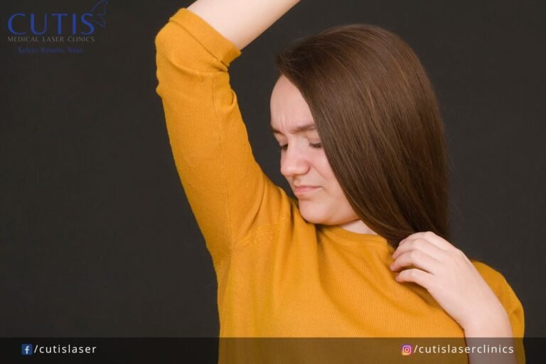 Excessive Sweating? Learn the Facts About Hyperhidrosis