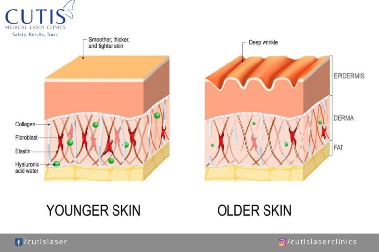 Why Your Skin Looks Dull and How to Fix it Before the Holidays