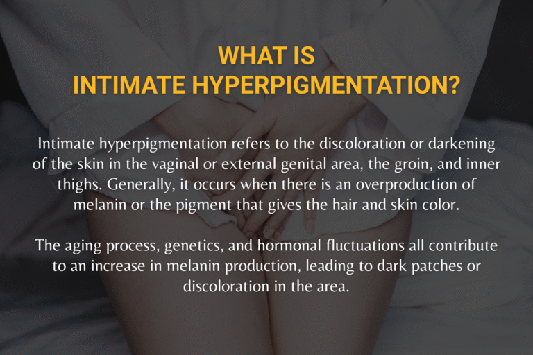Causes of Hyperpigmentation & Treatments