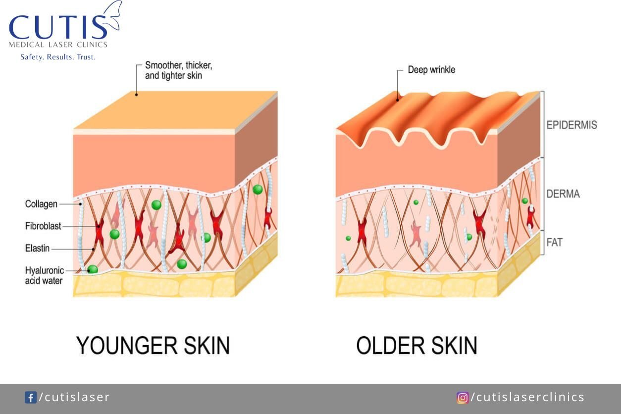 Early signs of aging