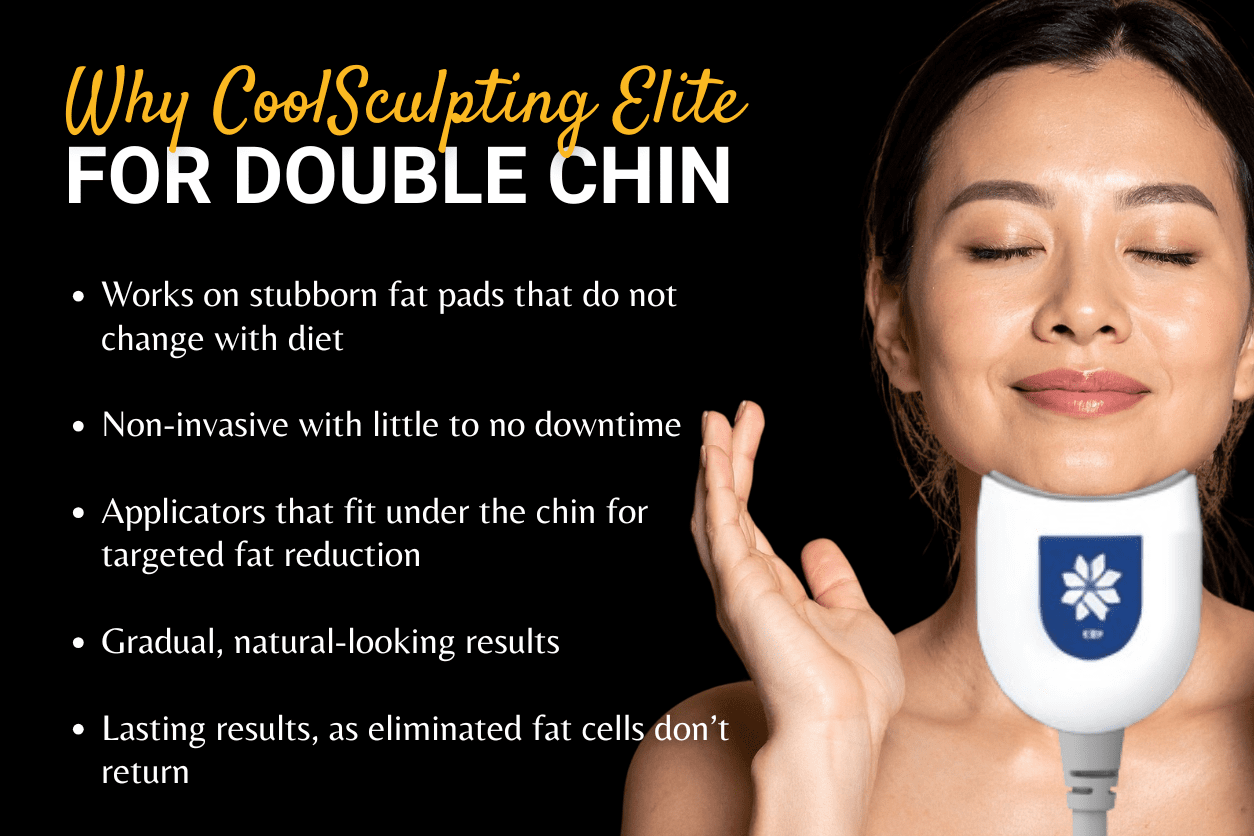 why coolsculpting for double chin