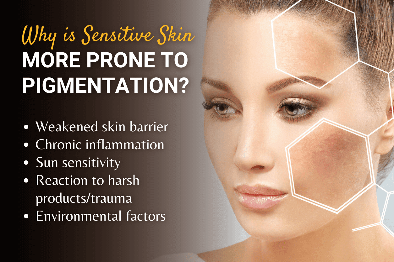 Pigmentation Treatment