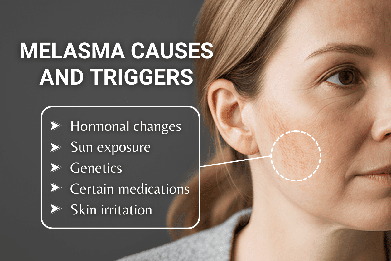 common triggers of melasma