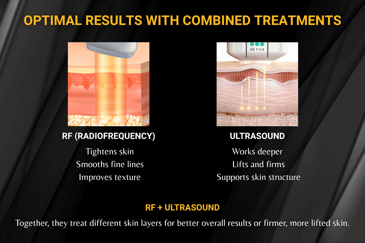 RF and Ultrasound A Team Effort