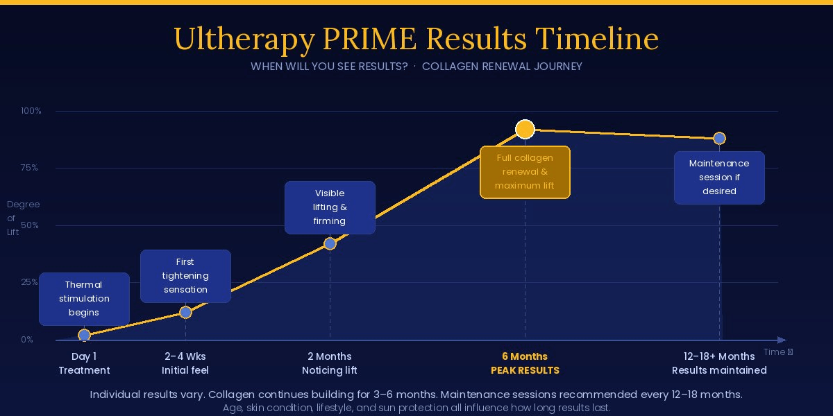 Results Timeline for Ultherapy Prime and How Long They Last 